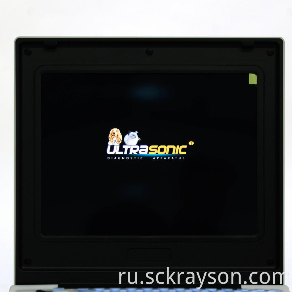Laptop Ultrasound Screen
